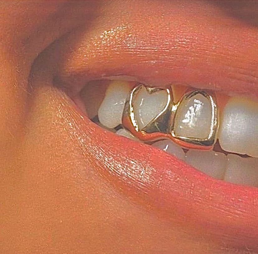 Body Jewelry Metal Types - 1/2/3/4/5Pcs ใหม่ประเภทยุโรปและอเมริกา Hollowed-Out รูปหัวใจคู่ชิ้น Braces, ต้องมีสําหรับ